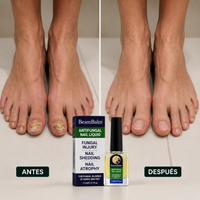 BeamBalm - Elimina los Hongos Desde la Raíz Sin Pastillas - HelixVital