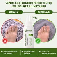 El Escudo que BeamBalm Necesita — Protege Zapatos, Pies y Uñas las 24h