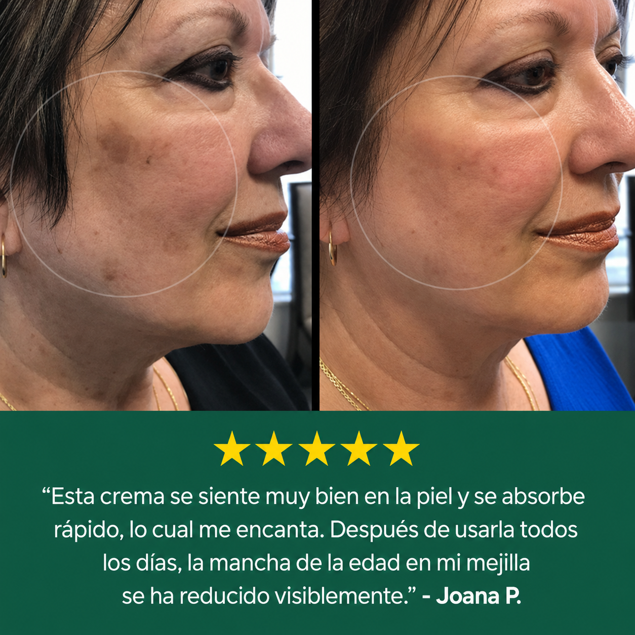 Crema antimanchas HelixVital™
