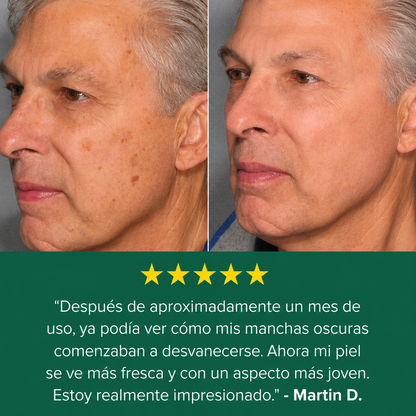 Crema antimanchas HelixVital™