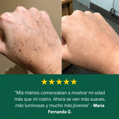 Crema antimanchas HelixVital™