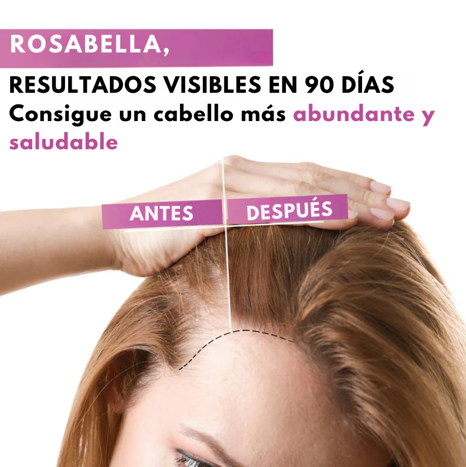 Rosabella Biotina - Tu Secreto para un Cabello y Uñas Espectaculares